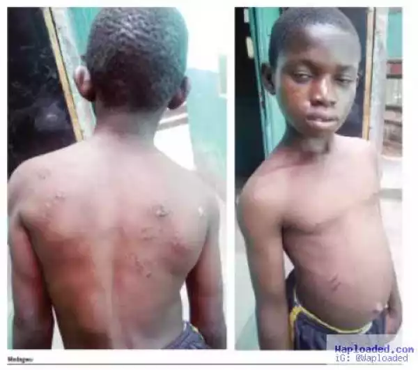 Photo: Why My Guardian Slashed My Body With Razor –12-Year-Old Narrates